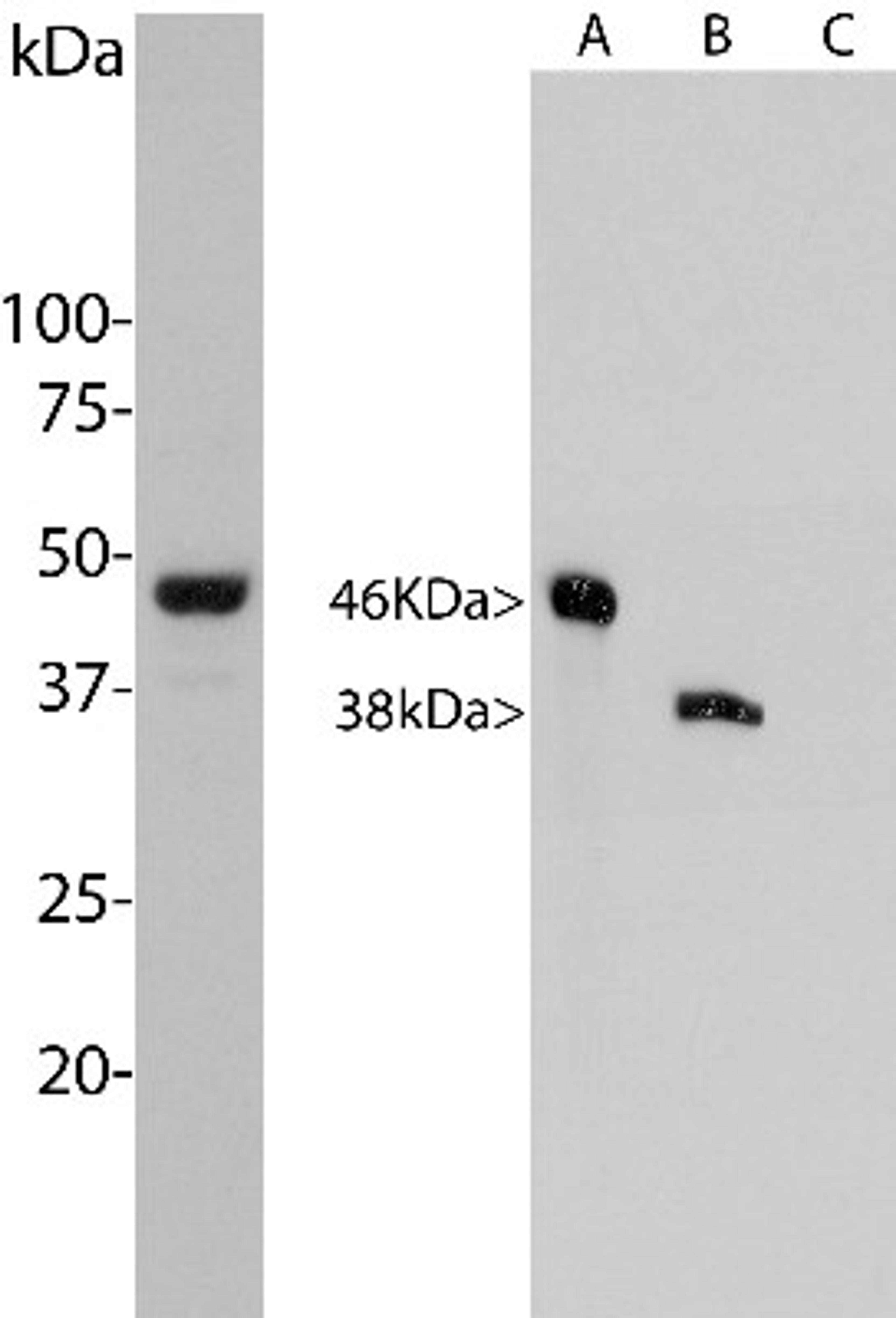 Western Blot: Aurora A/B Antibody (3H1) [NBP2-50043] - Left: Analysis of HeLa cells treated with 100ng/ml nocodazole for 18 h was probed with NBP2-50043. Nocodazole is a microtubule depolymerizing agent which induces cells to halt at the G2/M phase and also induces Aurora A expression. NBP2-50043 binds strongly to a band at about 46 kDa, which is Aurora A and also shows binding to a band at 38 kDa. Right: Blots of recombinant human Aurora A, B and C were probed with NBP2-50043, which binds to both Aurora A and B. We conclude that the 38 kDa band seen in the HeLa extract is Aurora B.