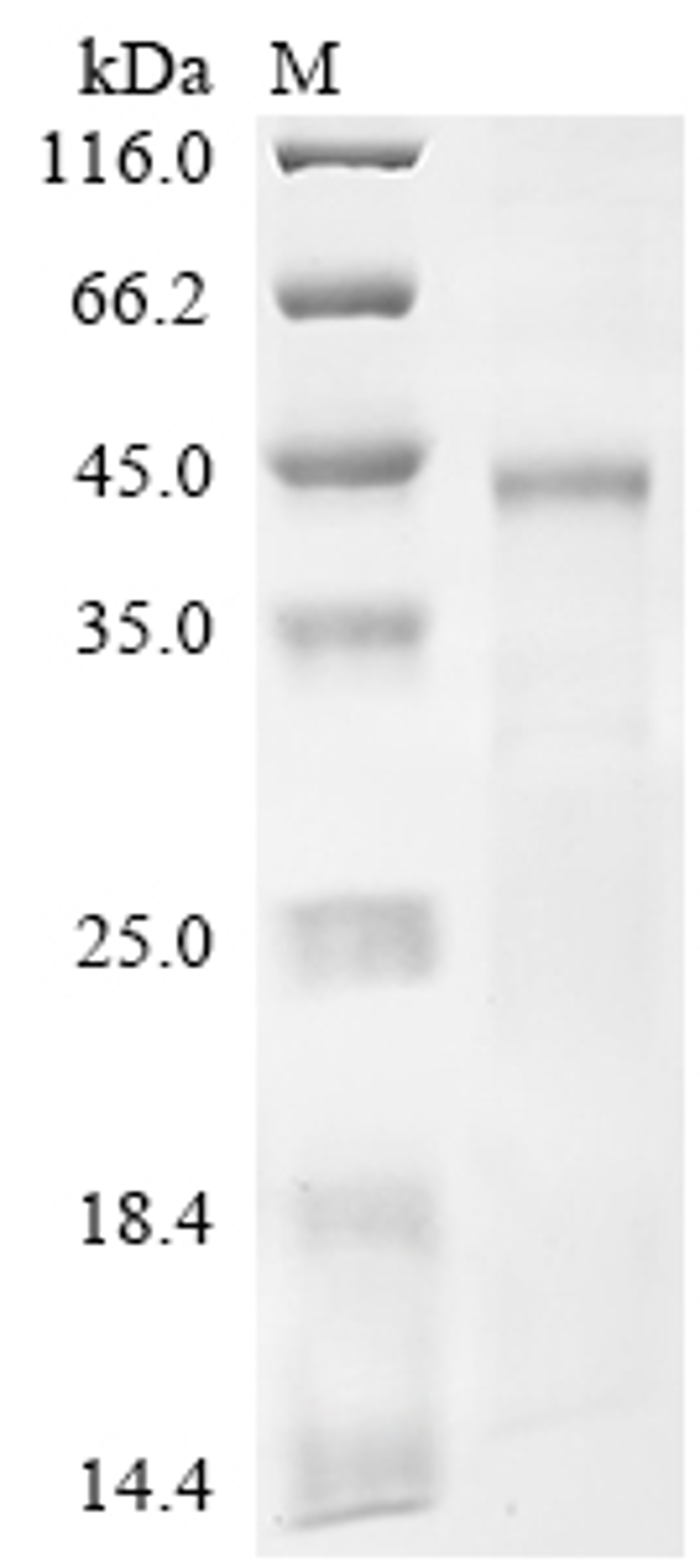 (Tris-Glycine gel) Discontinuous SDS-PAGE (reduced) with 5% enrichment gel and 15% separation gel.