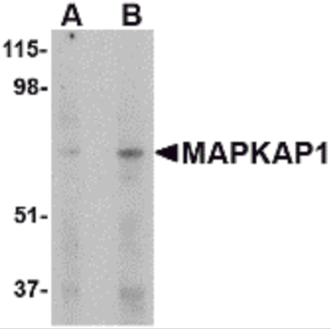 Western blot analysis of MAPKAP1 in human skeletal muscle tissue lysate with MAPKAP1 antibody at (A) 1 and (B) 2 μg/mL.