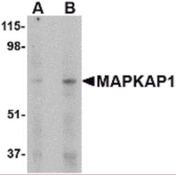 Western blot analysis of MAPKAP1 in human skeletal muscle tissue lysate with MAPKAP1 antibody at (A) 1 and (B) 2 μg/mL.