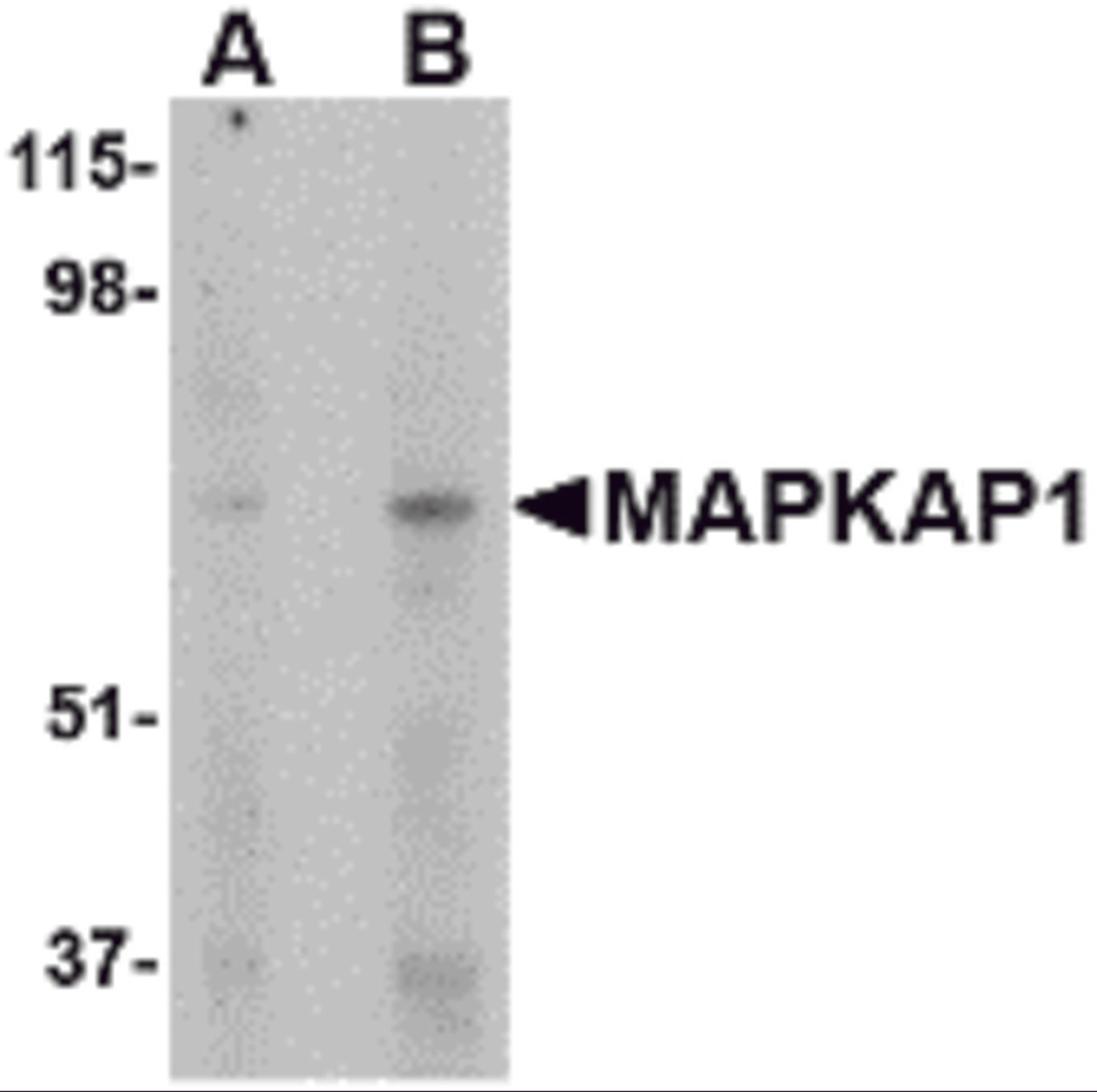Western blot analysis of MAPKAP1 in human skeletal muscle tissue lysate with MAPKAP1 antibody at (A) 1 and (B) 2 μg/mL.