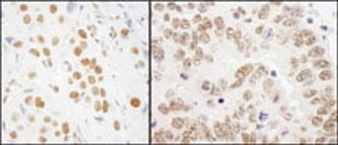 Detection of human and mouse RALY by immunohistochemistry.