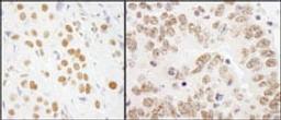 Detection of human and mouse RALY by immunohistochemistry.