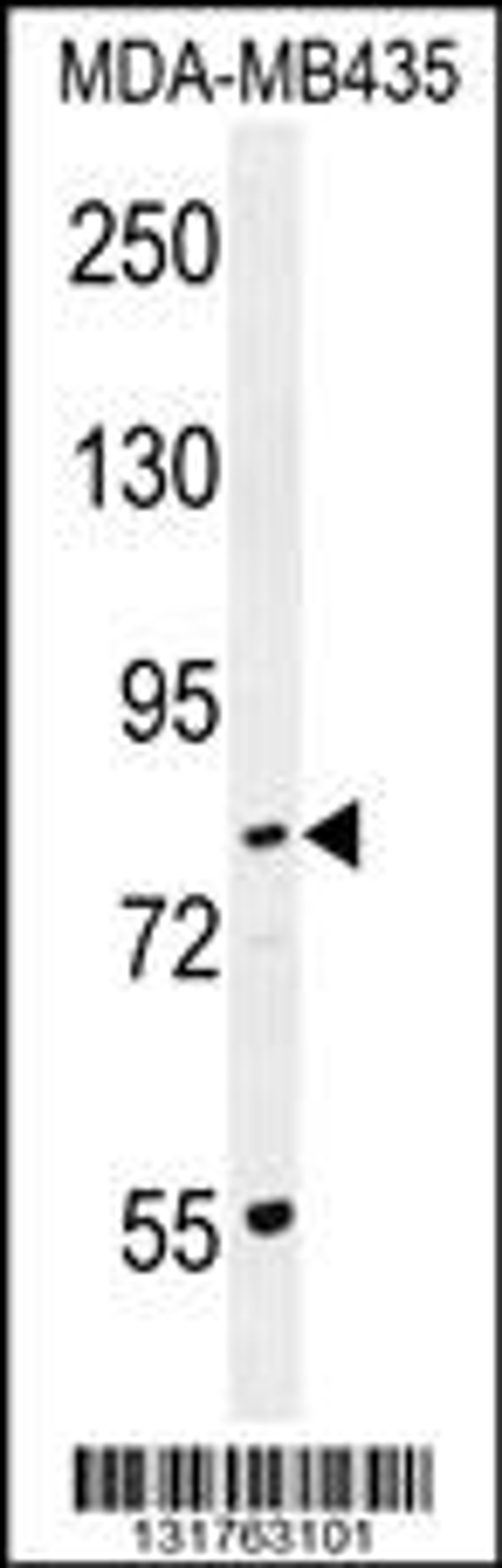 Western blot analysis in MDA-MB435 cell line lysates (35ug/lane).