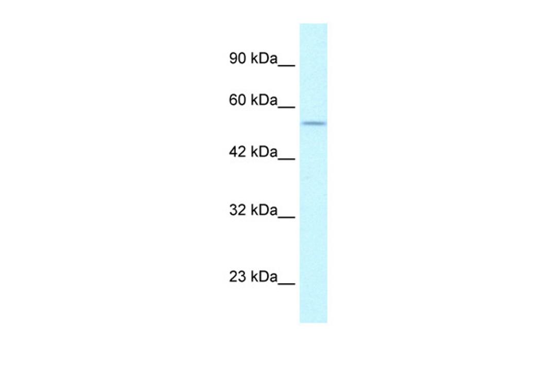 Antibody used in WB on Human HepG2 at 1.25 ug/ml.