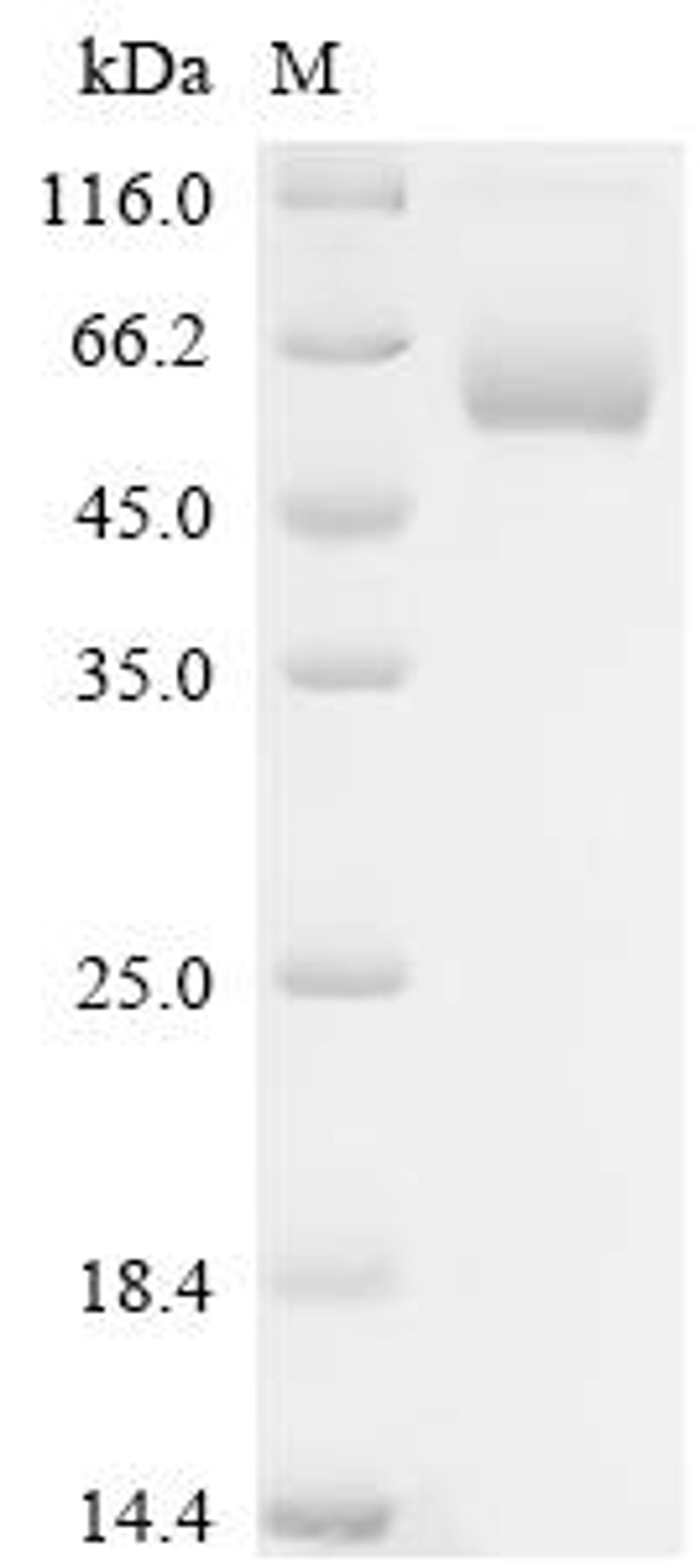 (Tris-Glycine gel) Discontinuous SDS-PAGE (reduced) with 5% enrichment gel and 15% separation gel.