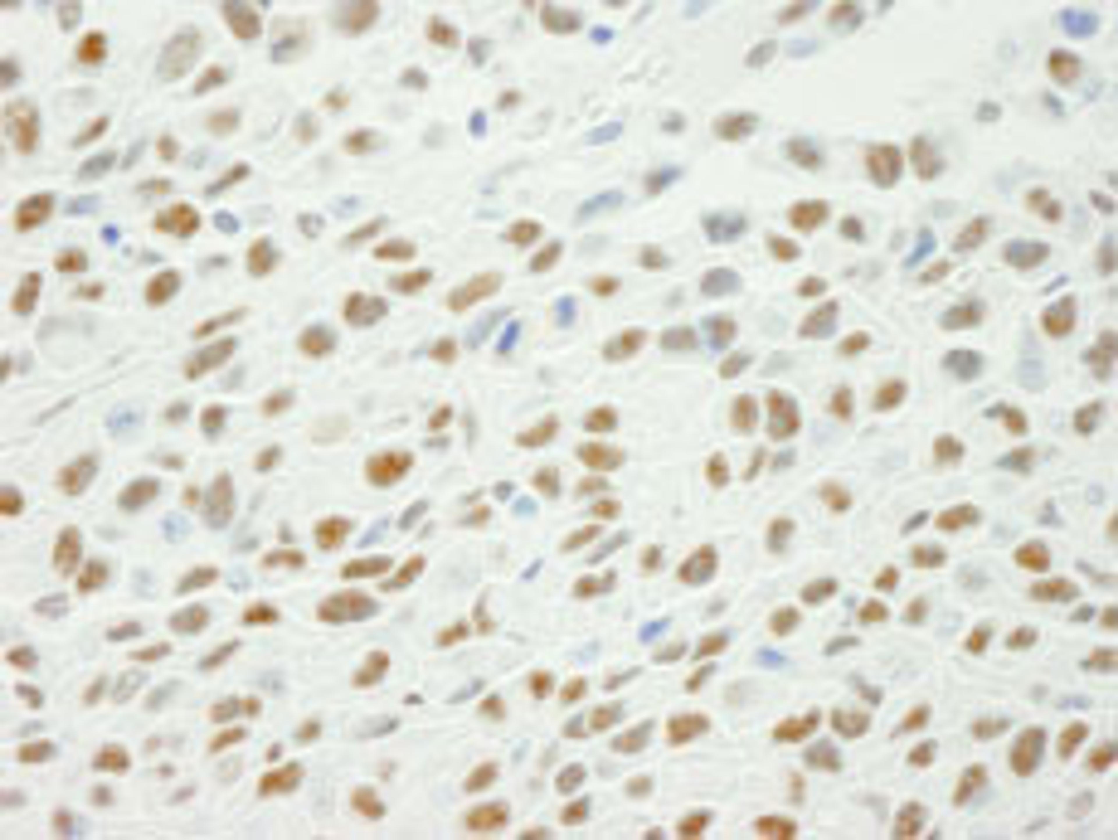 Detection of mouse Phospho XRCC1 (S461) by immunohistochemistry.