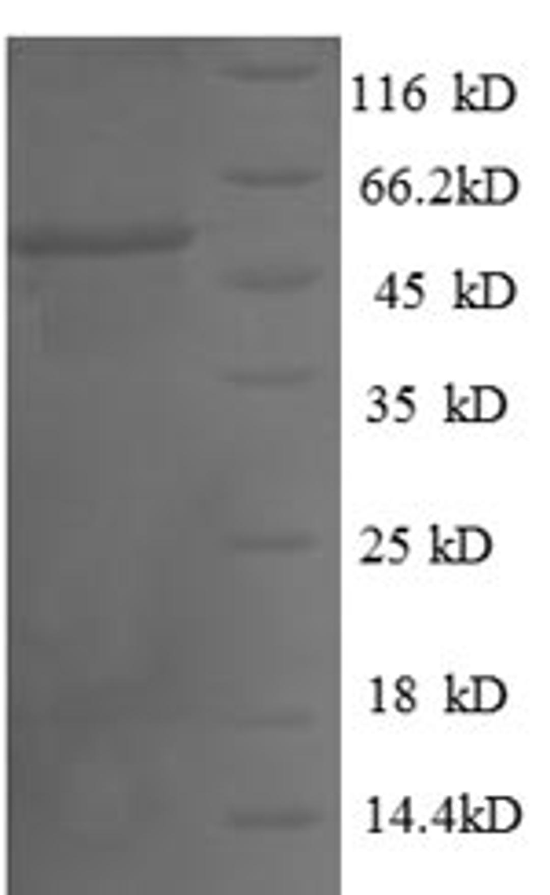 (Tris-Glycine gel) Discontinuous SDS-PAGE (reduced) with 5% enrichment gel and 15% separation gel.