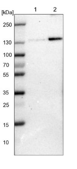 Western Blot: FAM120A Antibody [NBP1-86715] - Lane 1: NIH-3T3 cell lysate (Mouse embryonic fibroblast cells)<br/>Lane 2: NBT-II cell lysate (Rat Wistar bladder tumour cells)