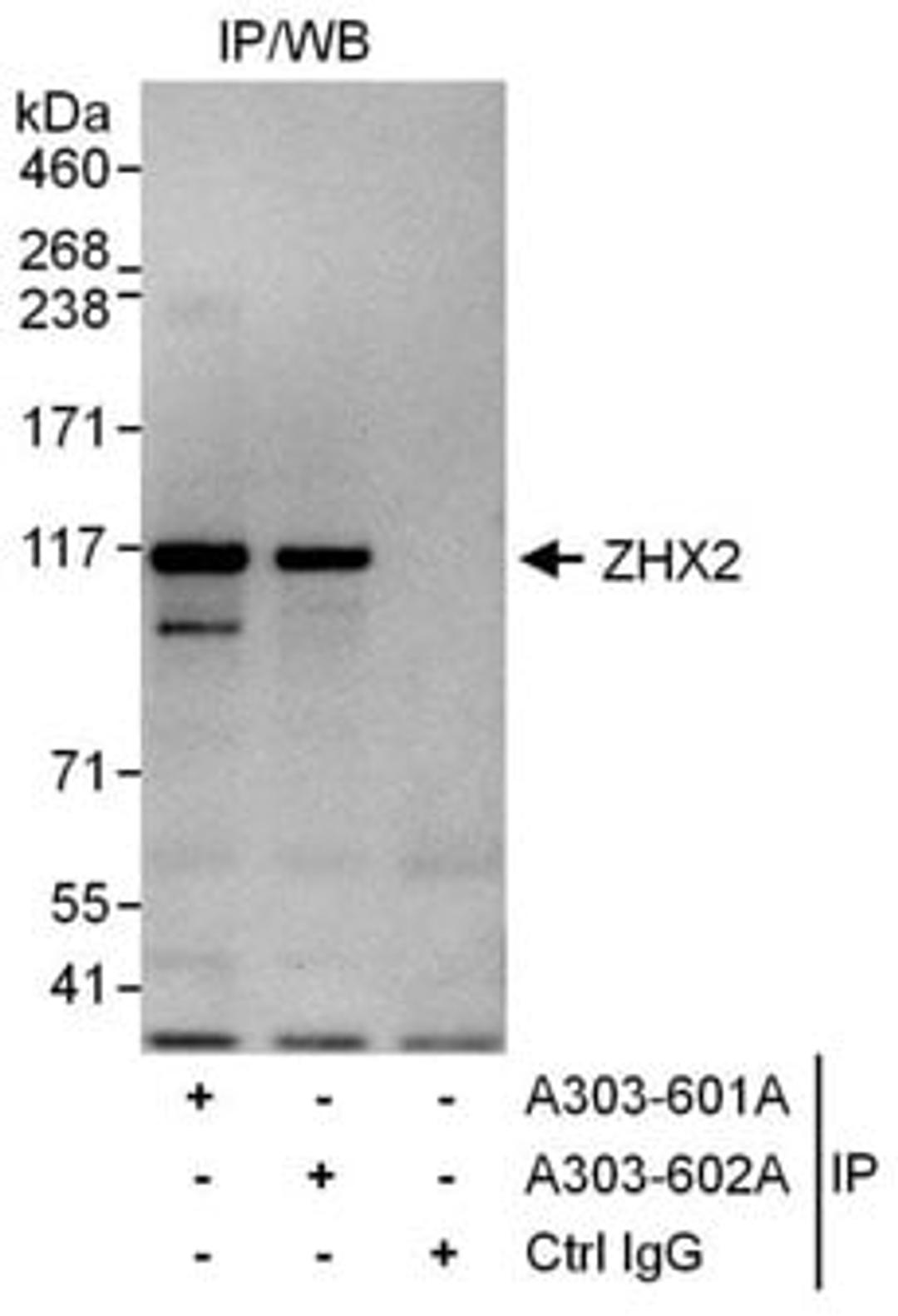 Detection of human ZHX2 by western blot of immunoprecipitates.