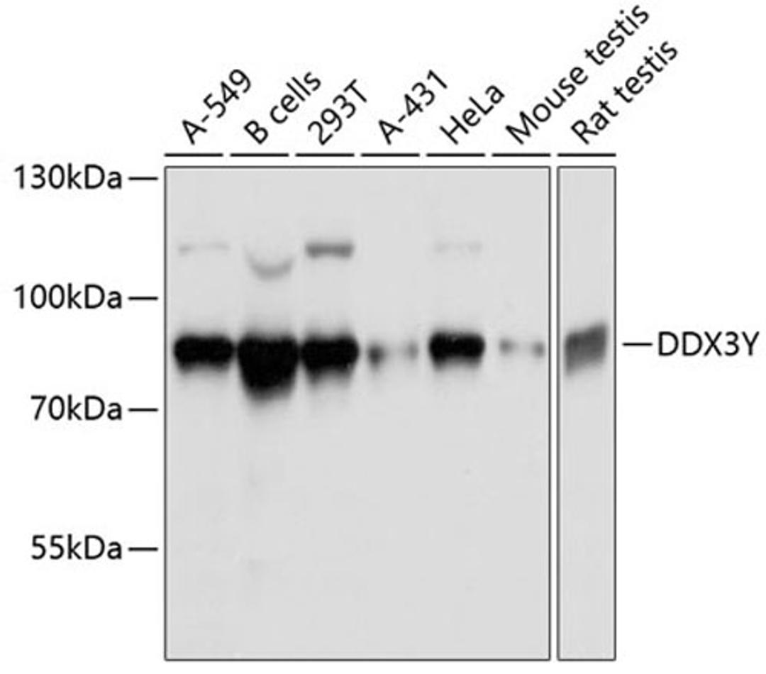 Western blot - DDX3Y antibody (A11704)