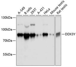 Western blot - DDX3Y antibody (A11704)