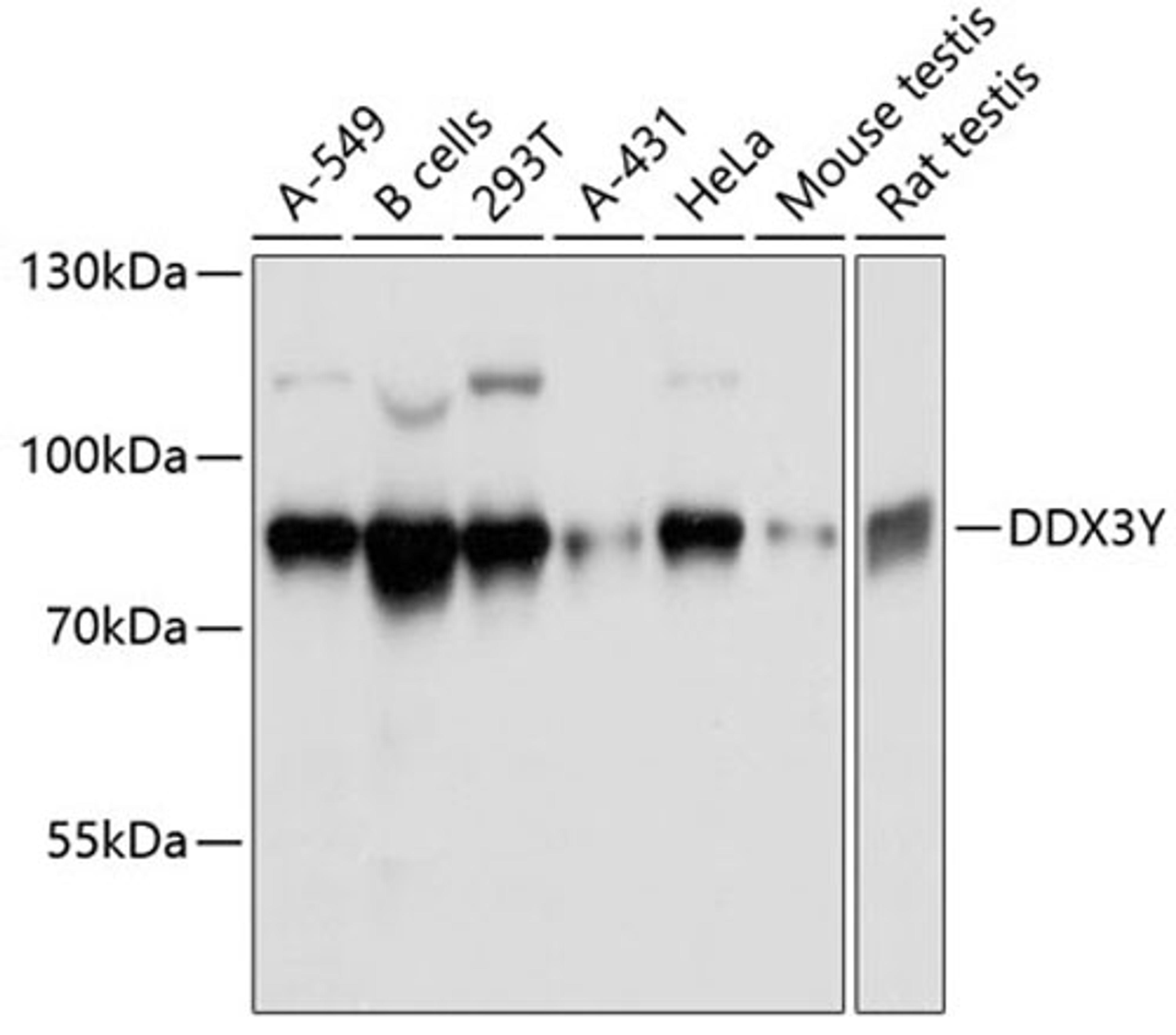 Western blot - DDX3Y antibody (A11704)