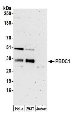 Detection of human PBDC1 by WB.