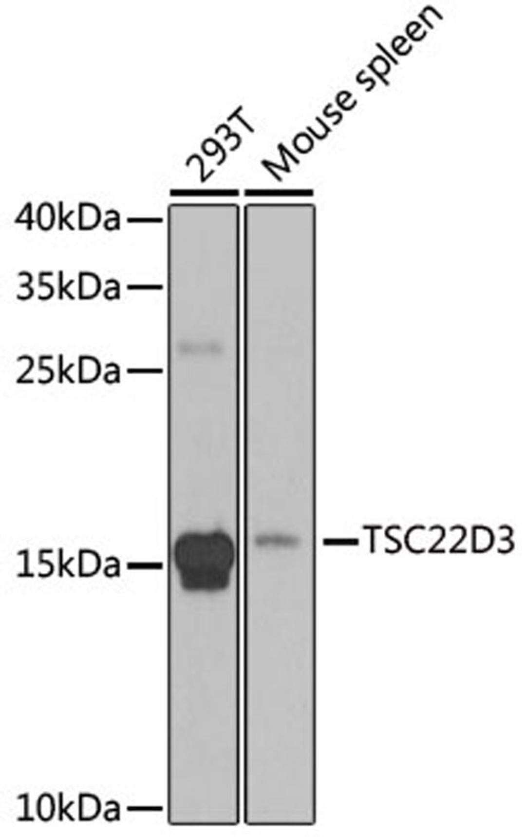 Western blot - TSC22D3 antibody (A6779)