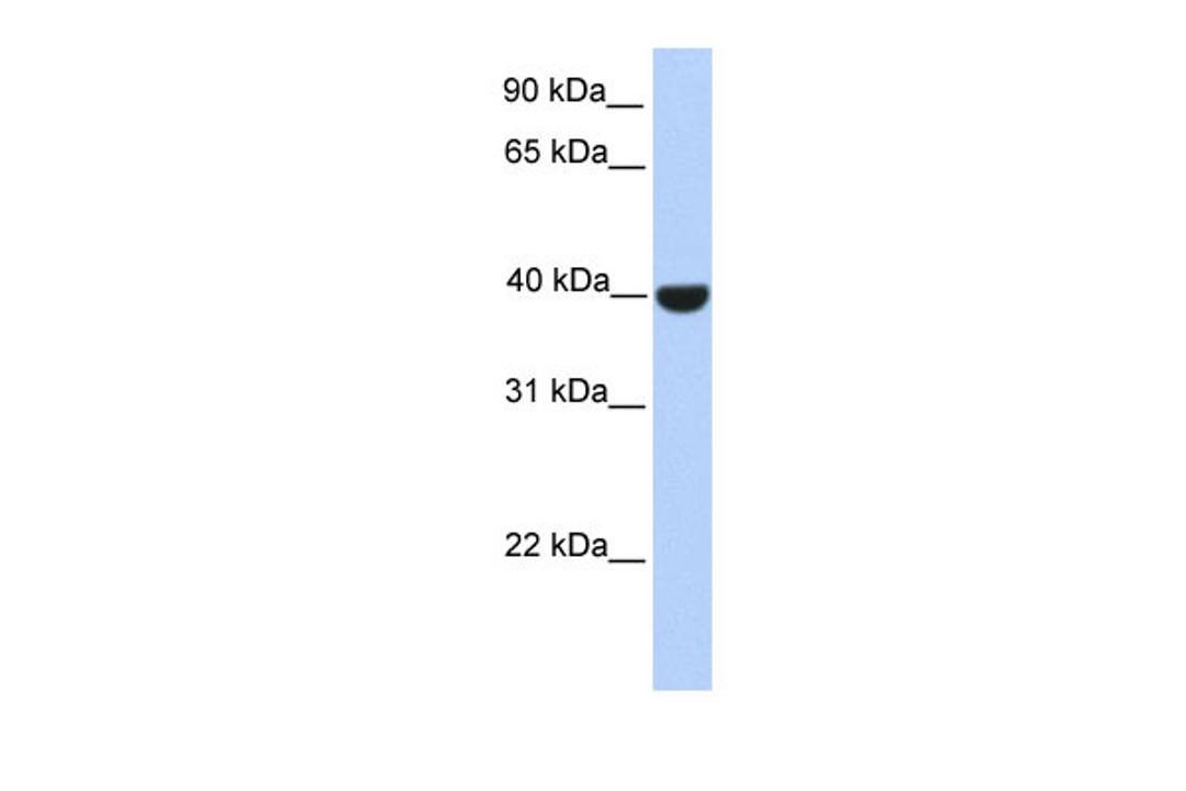 Antibody used in WB on Human Brain lysate at 0.2-1 ug/ml.