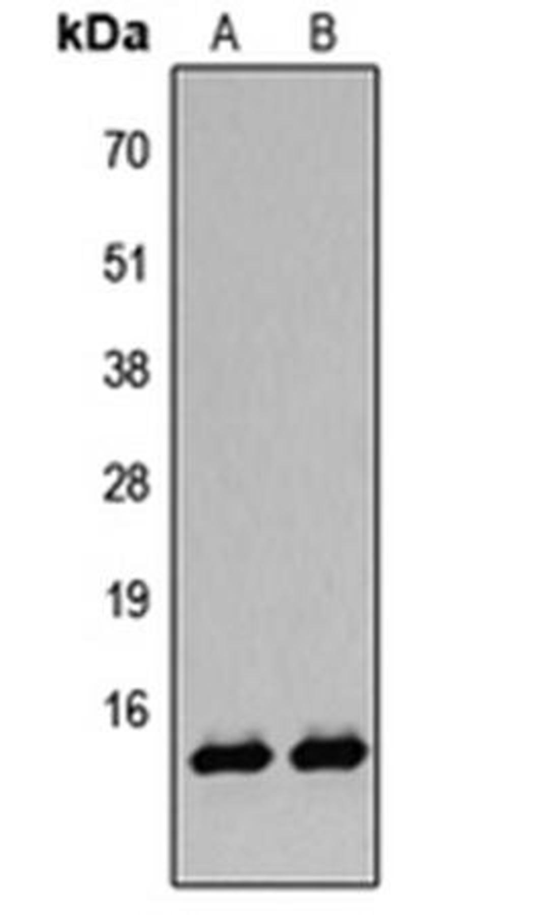 Western blot analysis of A431 TSA-treated (Lane1), HeLa TSA-treated (Lane2) whole cell using Histone H2B (AcK12) antibody