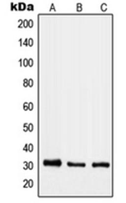 Western blot analysis of HeLa (Lane 1), mouse lung (Lane 2), rat heart (Lane 3) whole cell lysates using RAB40B antibody