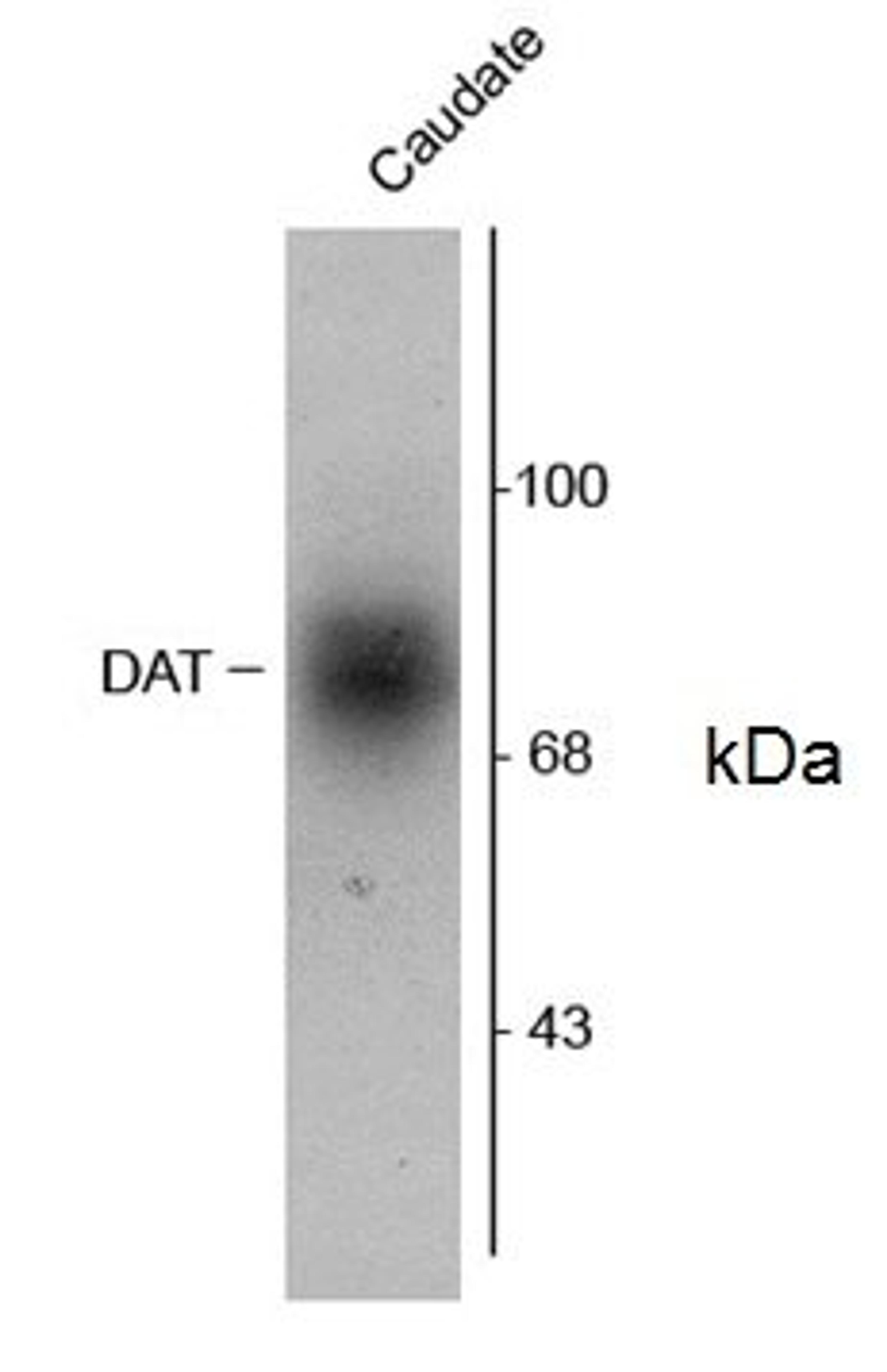 Western blot of 6&mu;g of human caudate lysate