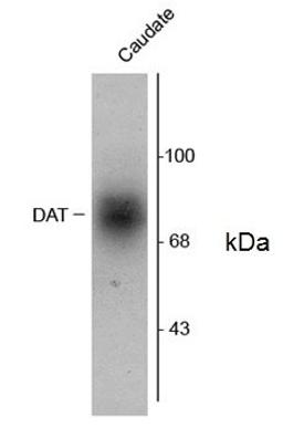 Western blot of 6μg of human caudate lysate