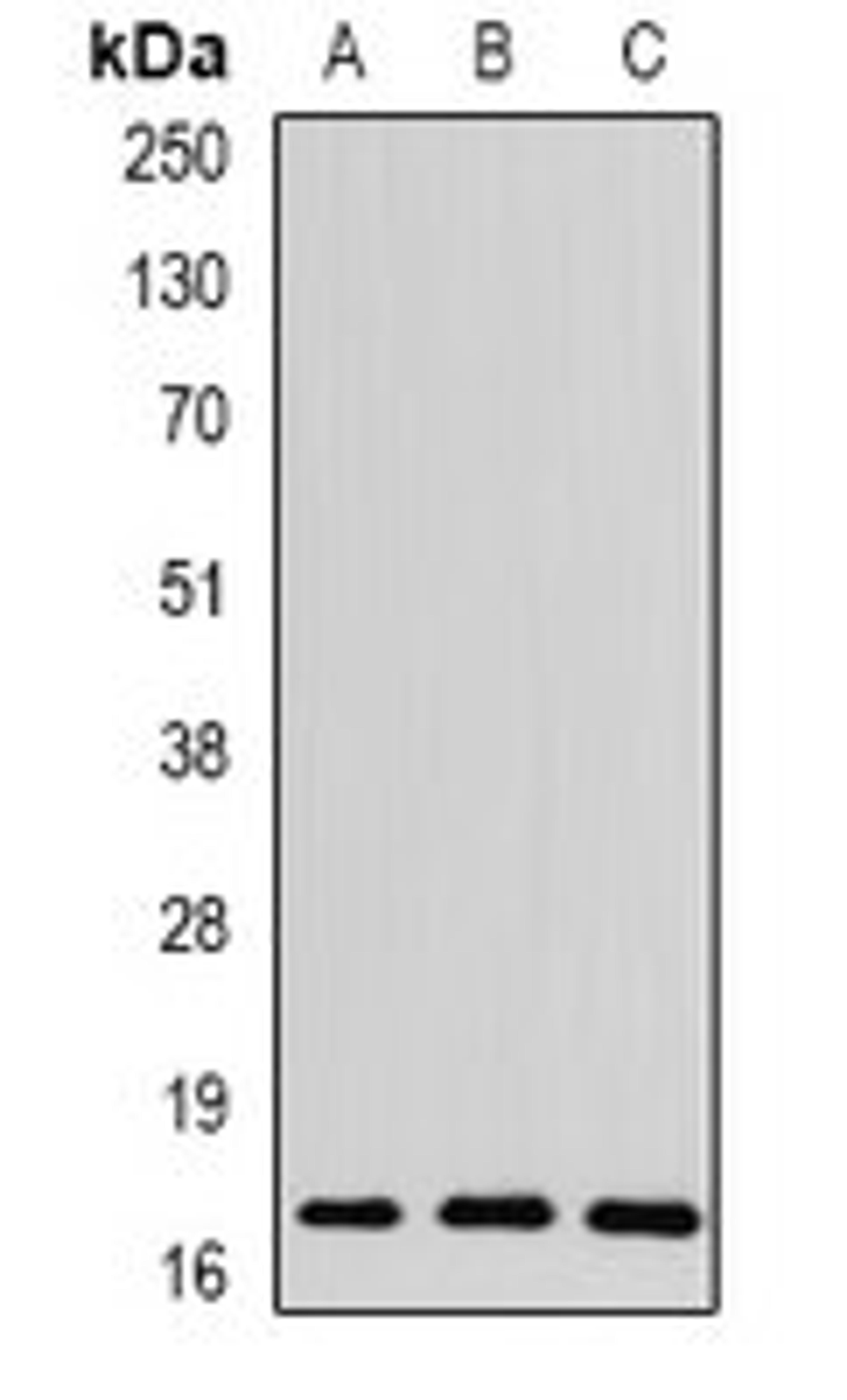 Western blot analysis of mouse liver (Lane1), rat brain (Lane2), rat heart (Lane3) whole cell lysates using THRSP antibody