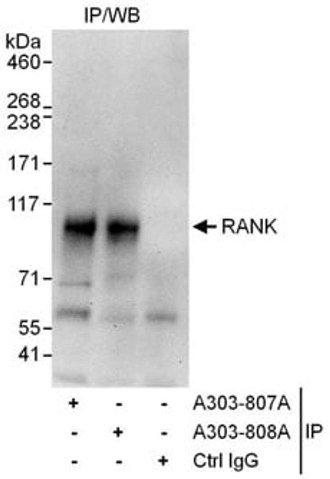 Detection of human RANK by western blot of immunoprecipitates.