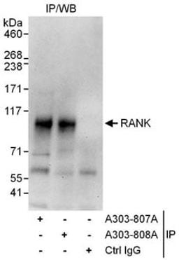 Detection of human RANK by western blot of immunoprecipitates.