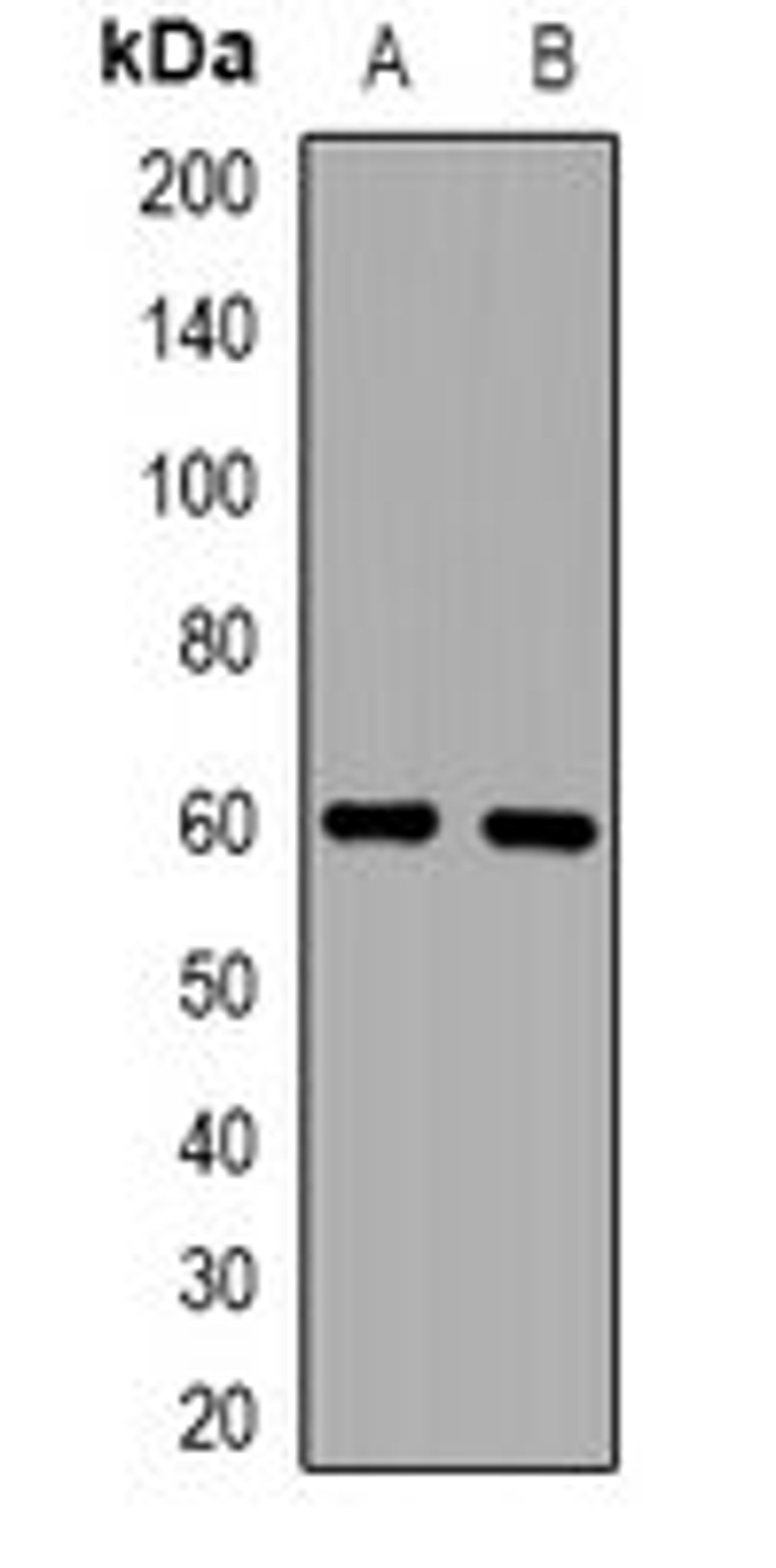 Western blot analysis of HepG2 (Lane1), HEK293T (Lane2) whole cell lysates using ZFP91 antibody