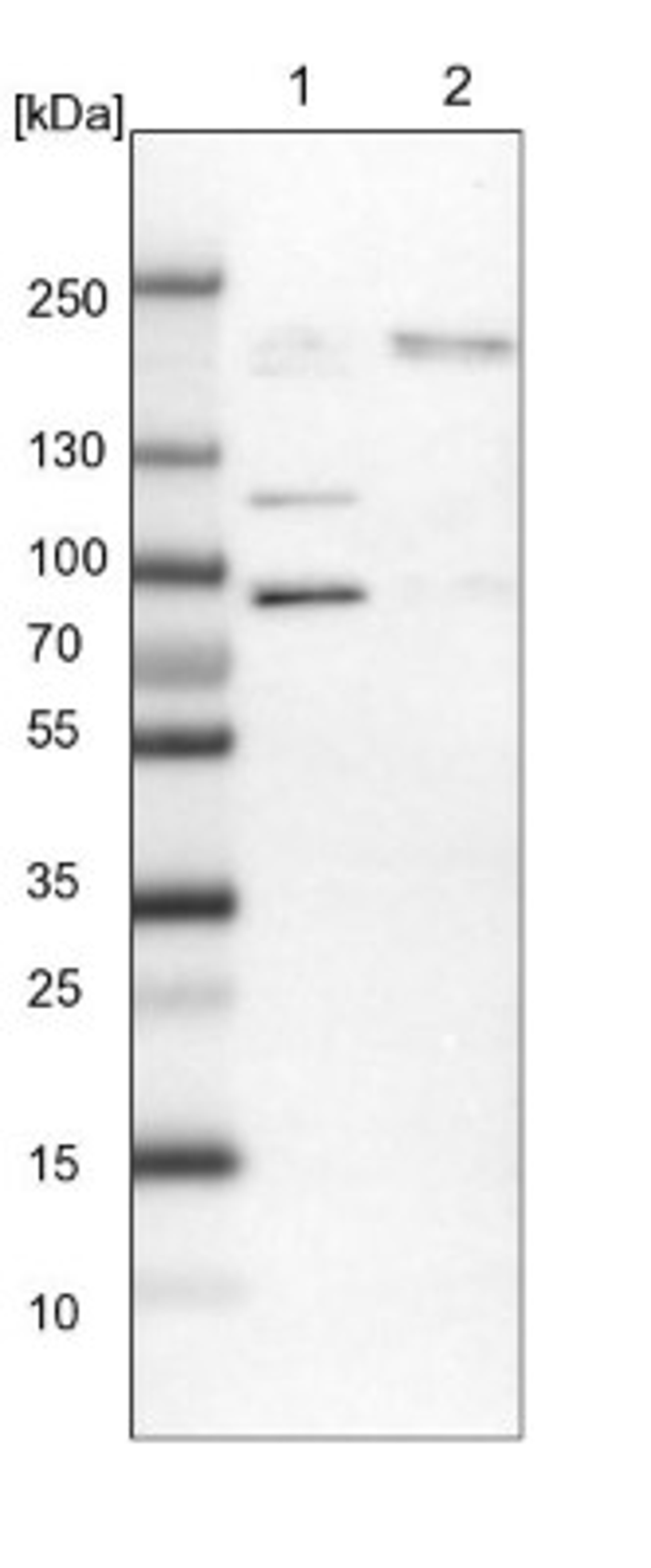 Western Blot: RBM33 Antibody [NBP1-84200] - Lane 1: NIH-3T3 cell lysate (Mouse embryonic fibroblast cells)<br/>Lane 2: NBT-II cell lysate (Rat Wistar bladder tumour cells)