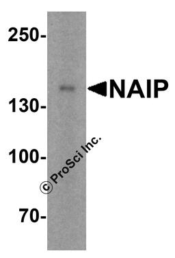 Western blot analysis of NAIP in human tonsil tissue lysate with NAIP antibody at 1 μg/mL.
