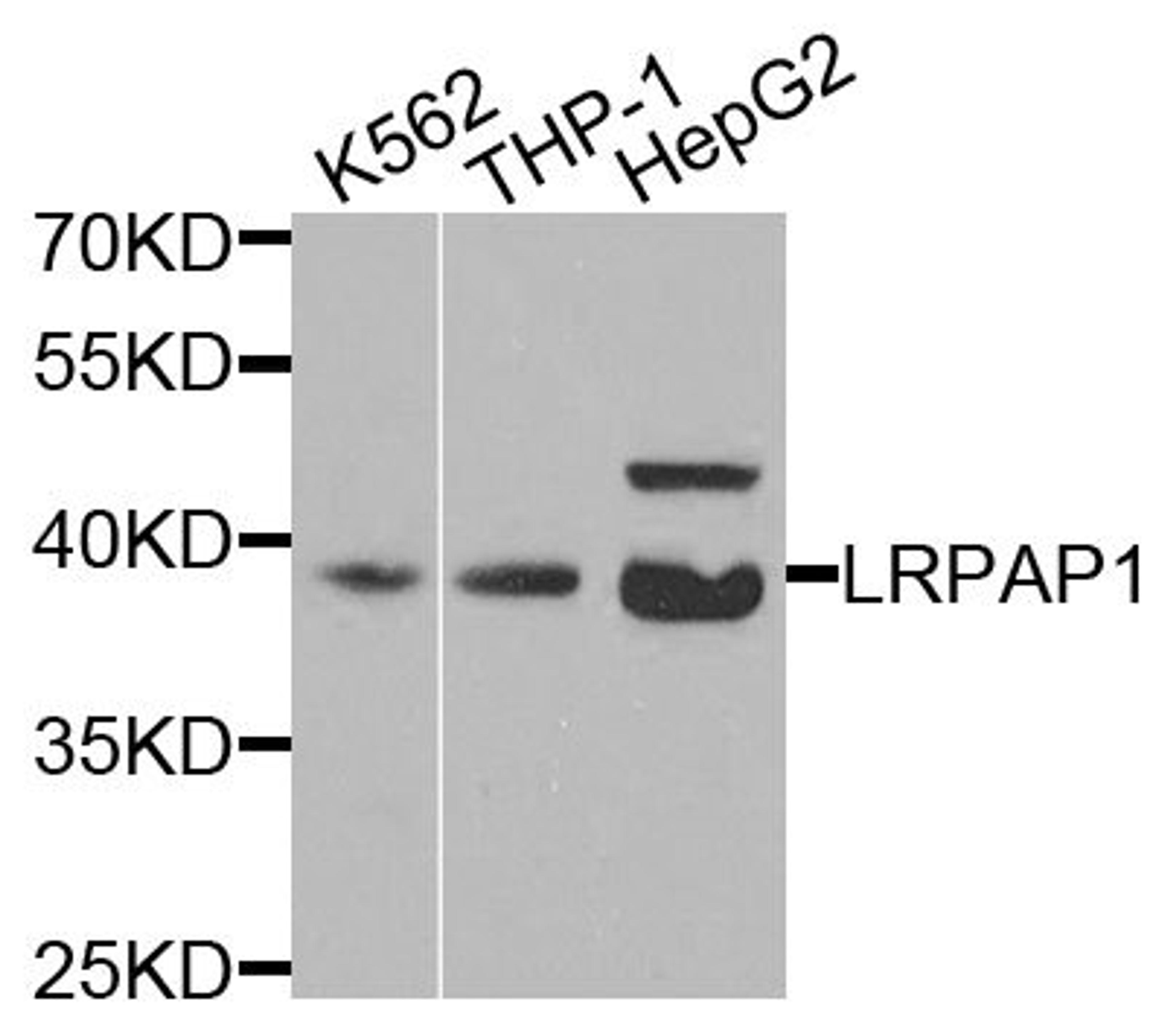 Western blot - LRPAP1 antibody (A3004)