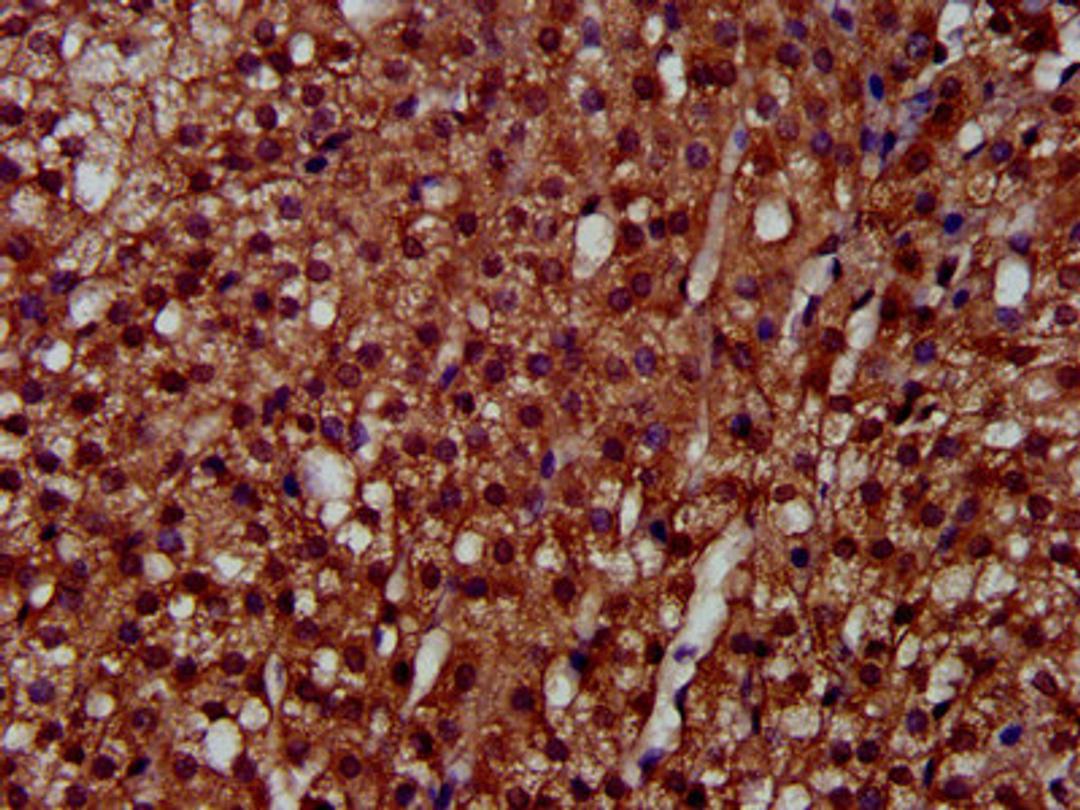 IHC image of CSB-PA621858LA01HU diluted at 1:300 and staining in paraffin-embedded human adrenal gland tissue performed on a Leica BondTM system. After dewaxing and hydration, antigen retrieval was mediated by high pressure in a citrate buffer (pH 6.0). Section was blocked with 10% normal goat serum 30min at RT. Then primary antibody (1% BSA) was incubated at 4°C overnight. The primary is detected by a biotinylated secondary antibody and visualized using an HRP conjugated SP system.