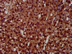 IHC image of CSB-PA621858LA01HU diluted at 1:300 and staining in paraffin-embedded human adrenal gland tissue performed on a Leica BondTM system. After dewaxing and hydration, antigen retrieval was mediated by high pressure in a citrate buffer (pH 6.0). Section was blocked with 10% normal goat serum 30min at RT. Then primary antibody (1% BSA) was incubated at 4°C overnight. The primary is detected by a biotinylated secondary antibody and visualized using an HRP conjugated SP system.