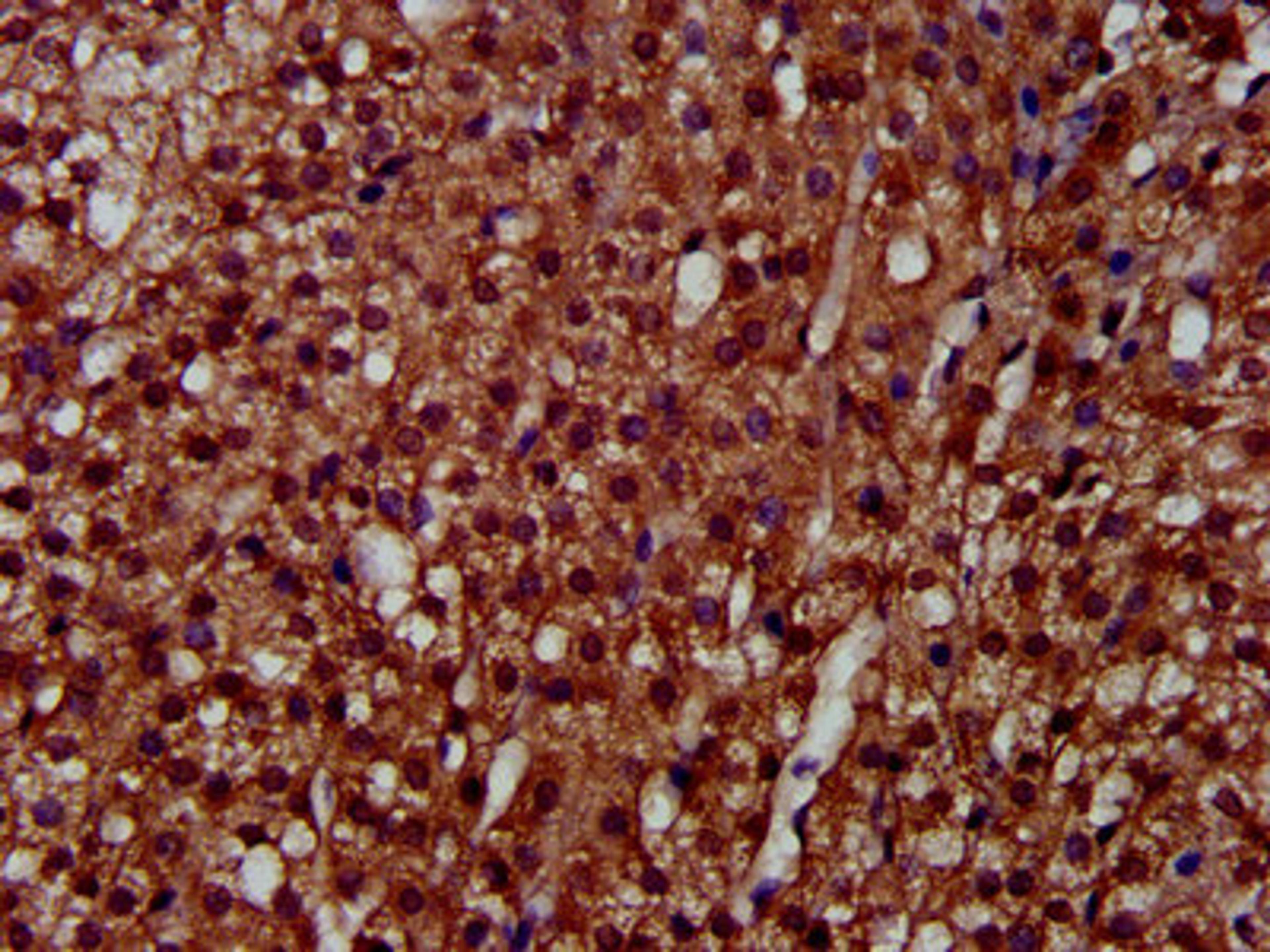 IHC image of CSB-PA621858LA01HU diluted at 1:300 and staining in paraffin-embedded human adrenal gland tissue performed on a Leica BondTM system. After dewaxing and hydration, antigen retrieval was mediated by high pressure in a citrate buffer (pH 6.0). Section was blocked with 10% normal goat serum 30min at RT. Then primary antibody (1% BSA) was incubated at 4°C overnight. The primary is detected by a biotinylated secondary antibody and visualized using an HRP conjugated SP system.