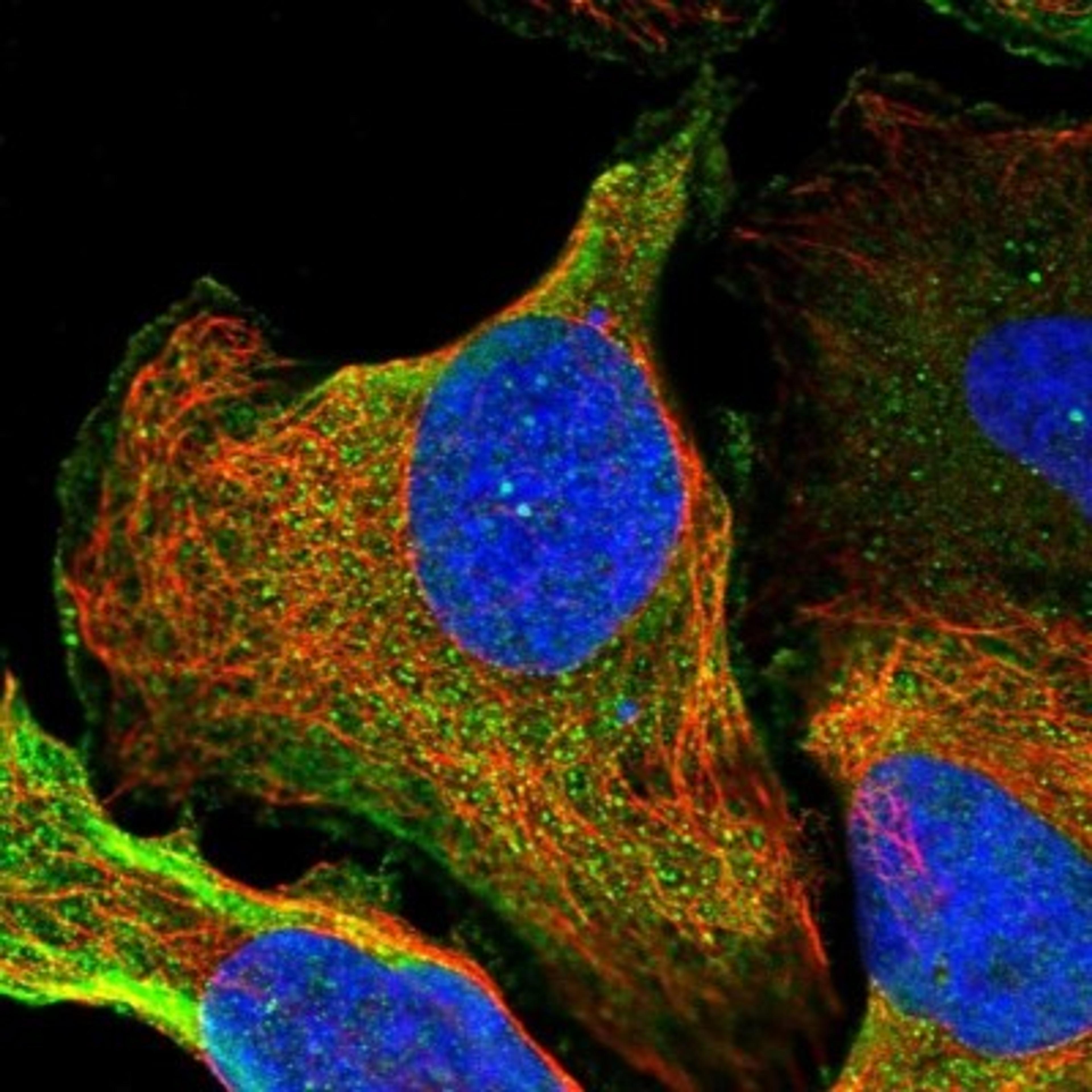 Immunocytochemistry/Immunofluorescence: ZNF227 Antibody [NBP1-85930] - Immunofluorescent staining of human cell line U-2 OS shows positivity in plasma membrane.