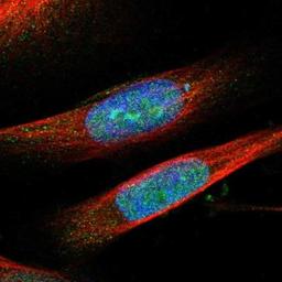 Immunocytochemistry/Immunofluorescence: SALL3 Antibody [NBP1-80587] - Immunofluorescent staining of human cell line U-251MG shows positivity in nucleus, nucleoli & cytoplasm.