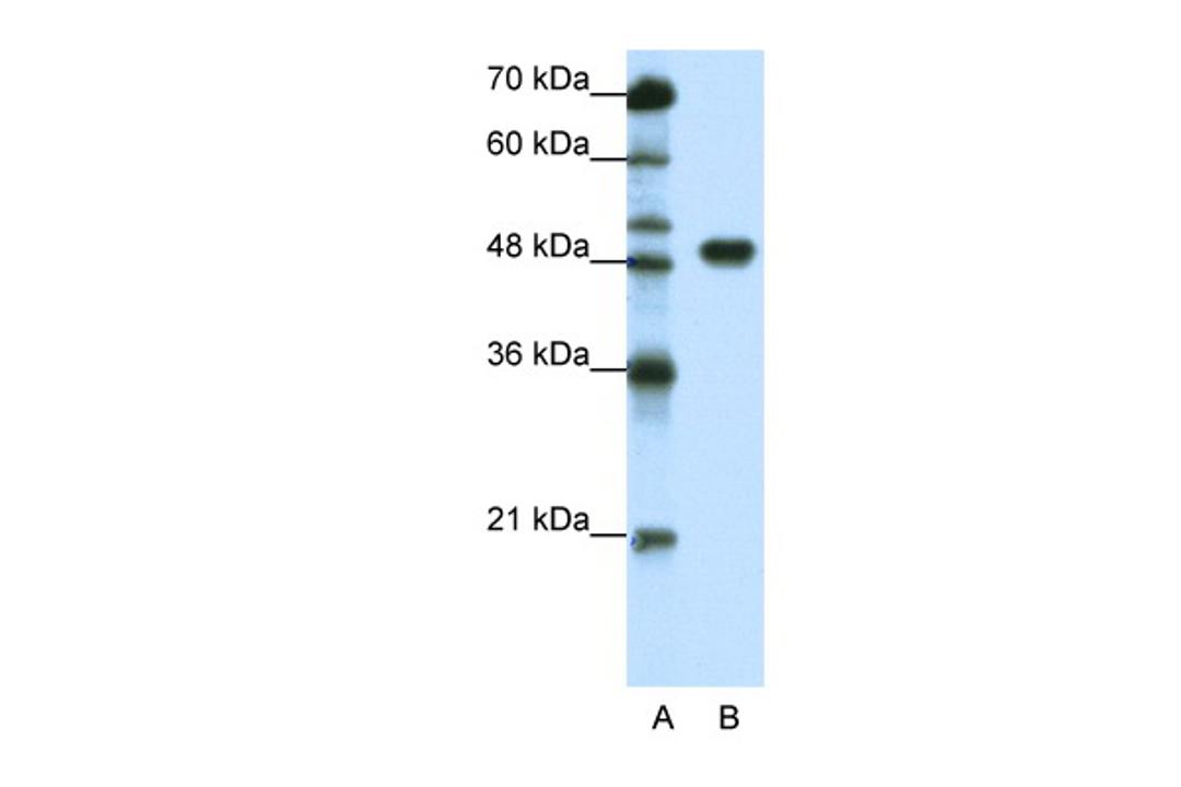 Antibody used in WB on Human HepG2 at 1.25 ug/ml.