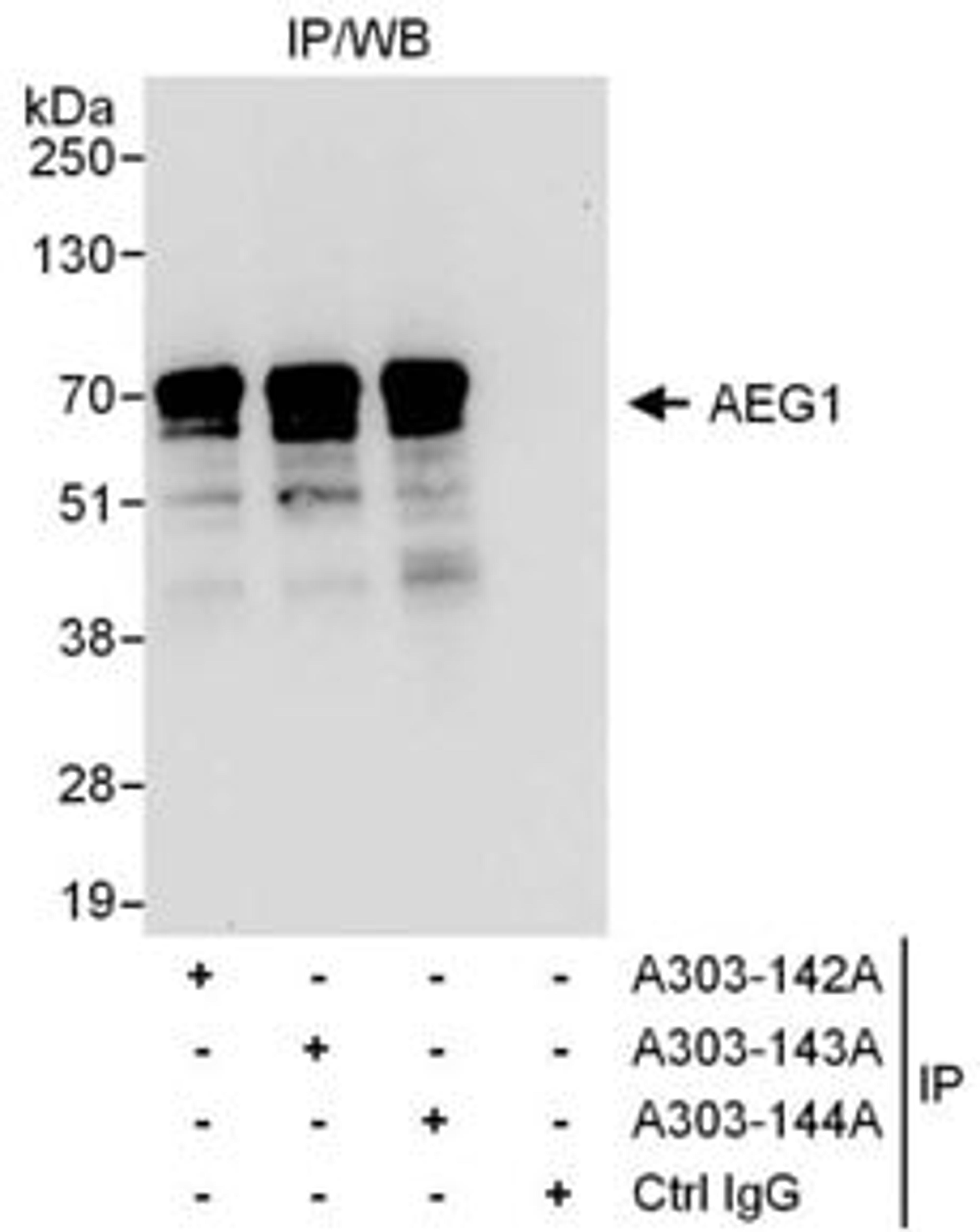 Detection of human AEG1 by western blot of immunoprecipitates.