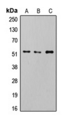 Western blot analysis of HeLa Calyculin A-treated (Lane 1), Jurkat (Lane 2) RAW264.7 (Lane 3) whole cell lysates using SMAD2/3 (phospho-T8) antibody