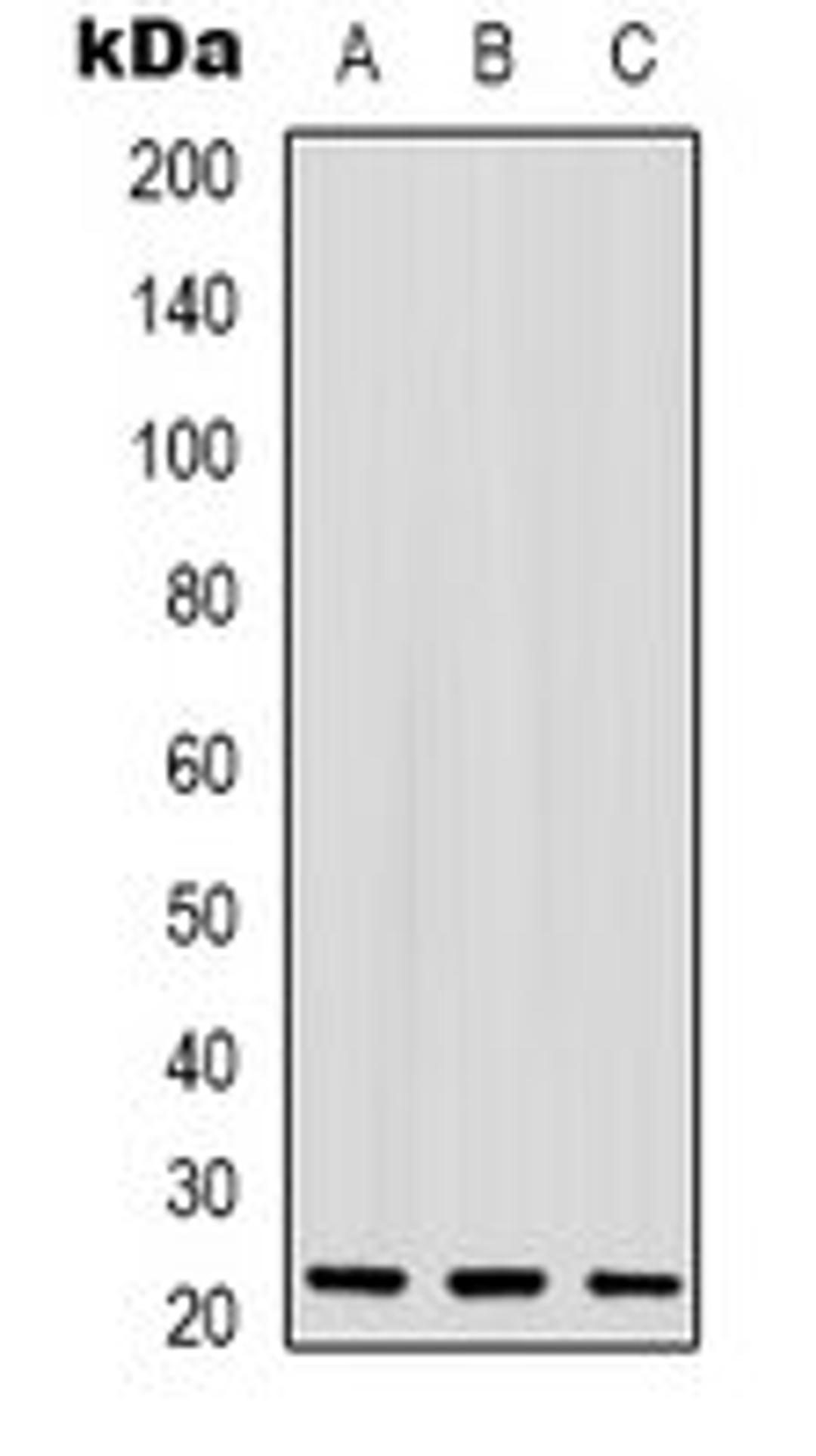 Western blot analysis of HepG2 (Lane 1), HEK293T (Lane 2), Hela (Lane 3) whole cell lysates using Cripto 3 antibody