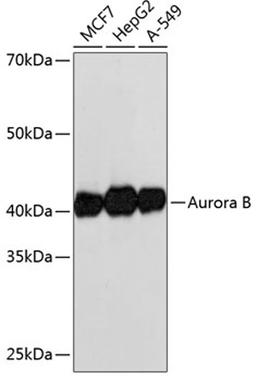 Western blot - Aurora B antibody (A19539)