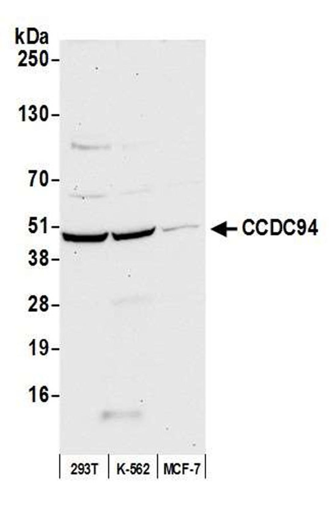 Detection of human CCDC94 by WB.