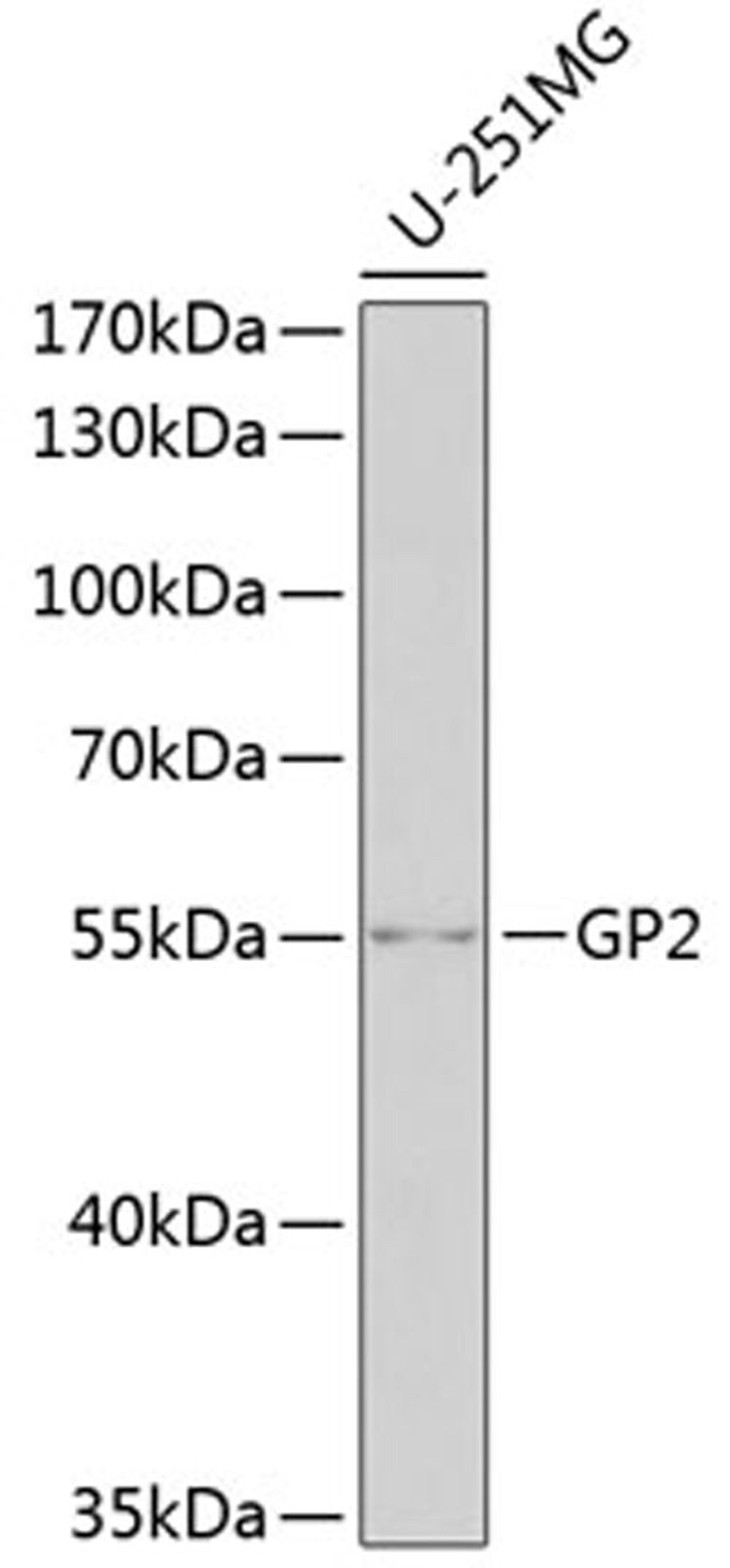 Western blot - GP2 antibody (A6378)