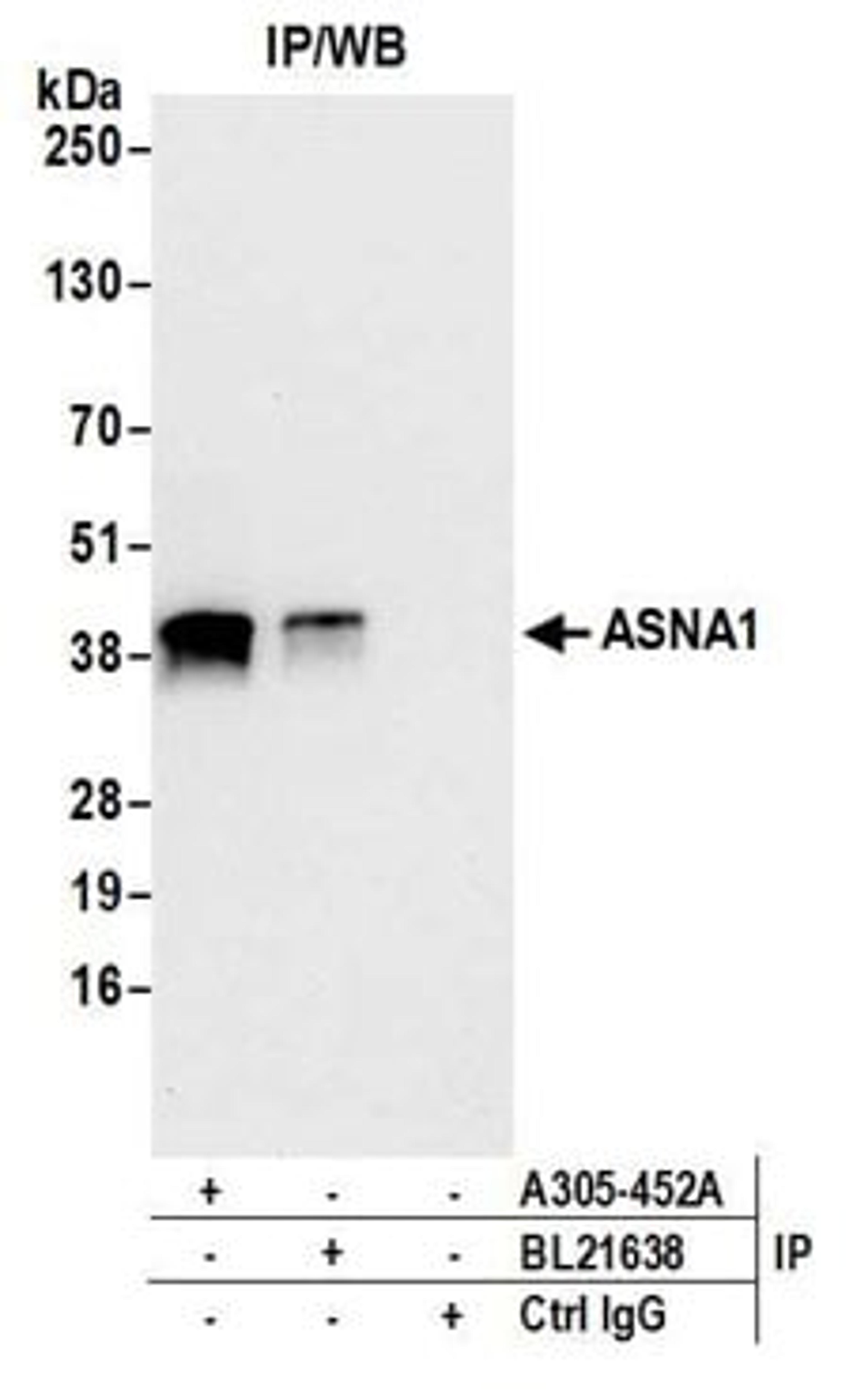 Detection of human ASNA1 by western blot of immunoprecipitates.