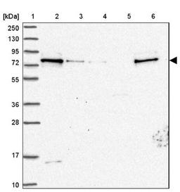 Western Blot: ZC3H14 Antibody [NBP2-13537] - Lane 1: Marker [kDa] 250, 130, 95, 72, 55, 36, 28, 17, 10<br/>Lane 2: Human cell line RT-4<br/>Lane 3: Human cell line U-251MG sp<br/>Lane 4: Human plasma (IgG/HSA depleted)<br/>Lane 5: Human liver tissue<br/>Lane 6: Human tonsil tissue