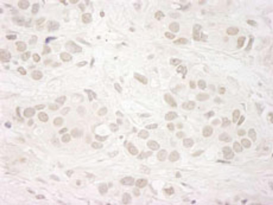 Detection of human JARID1A/RBP2 by immunohistochemistry.