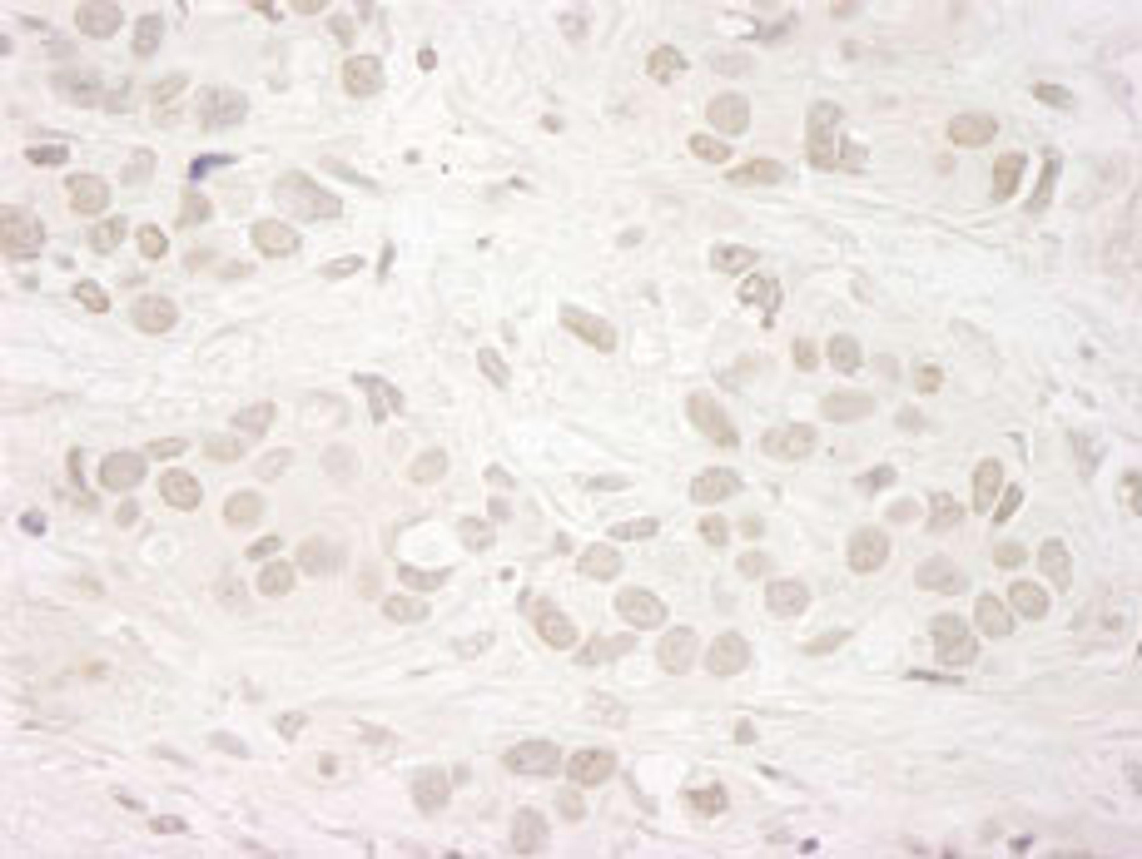 Detection of human JARID1A/RBP2 by immunohistochemistry.