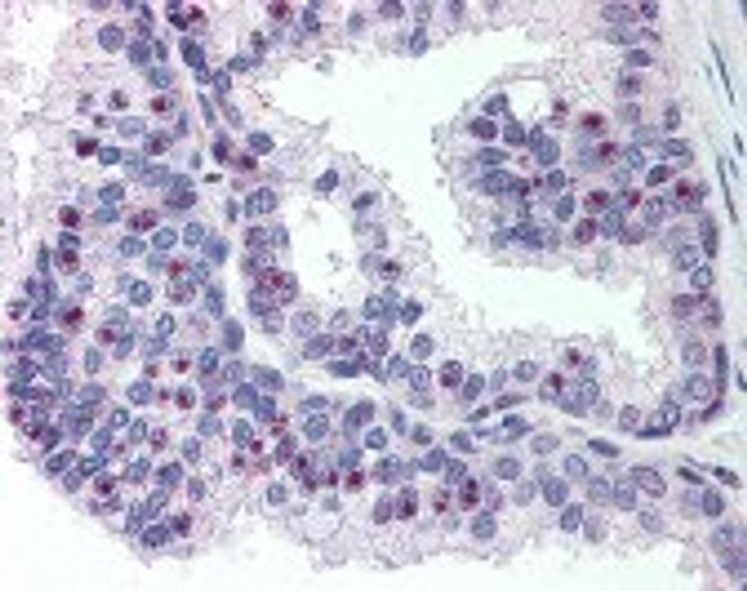 Immunohistochemistry staining of CHD2 in prostate tissue using CHD2 Antibody.