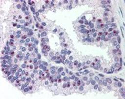 Immunohistochemistry staining of CHD2 in prostate tissue using CHD2 Antibody.