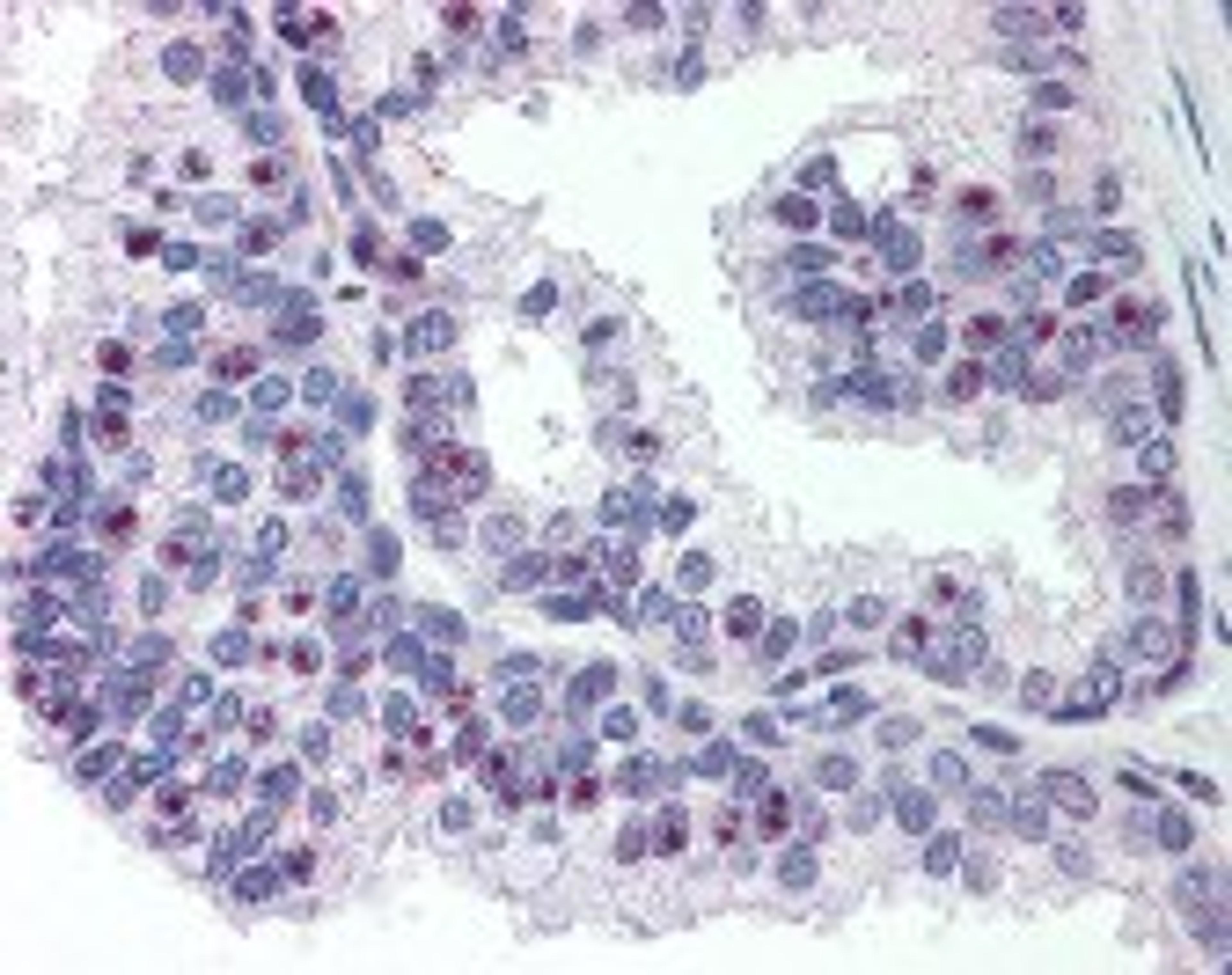 Immunohistochemistry staining of CHD2 in prostate tissue using CHD2 Antibody.